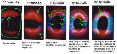 Cliente E